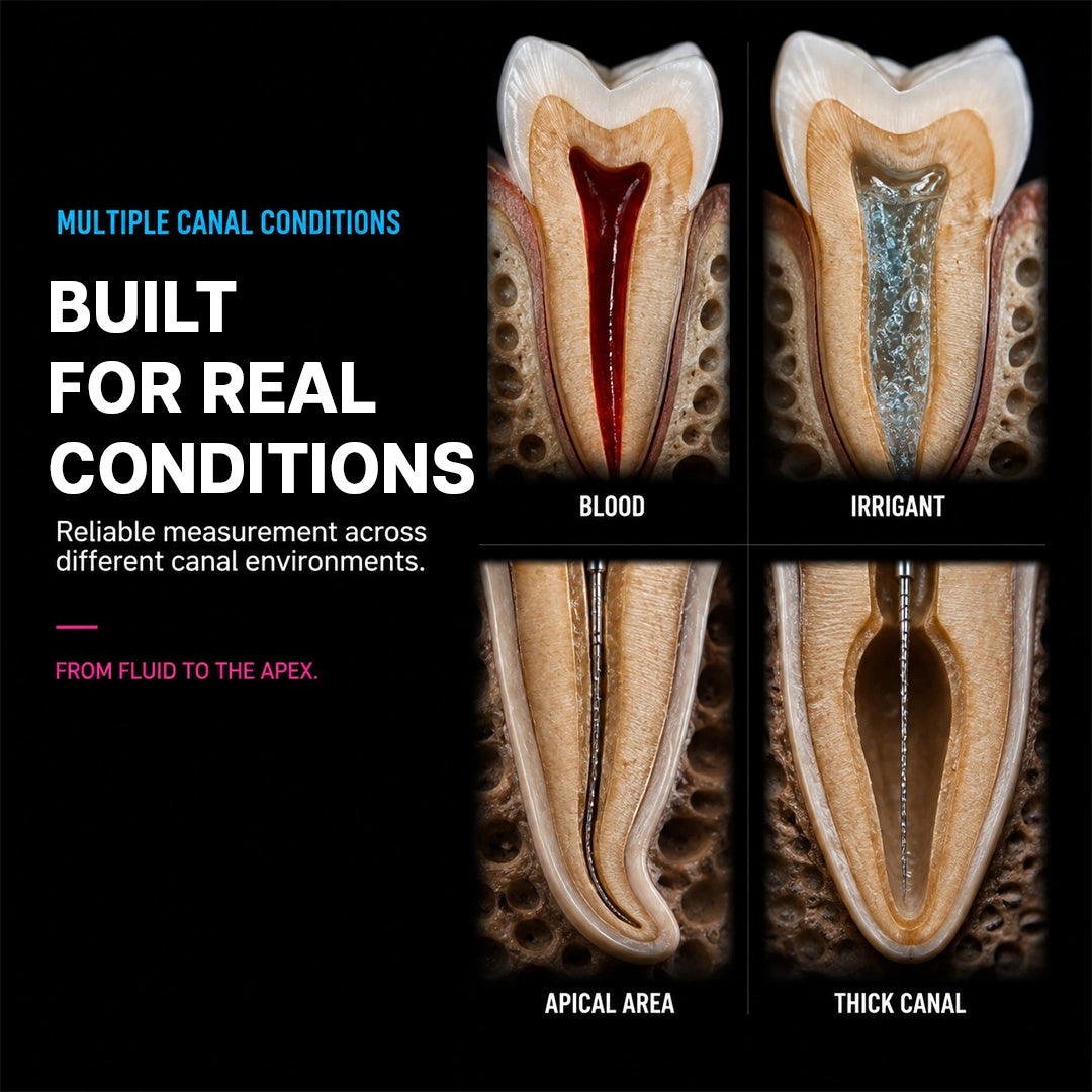 four tooth cross-sections showing blood, irrigant, apical area, and thick canal