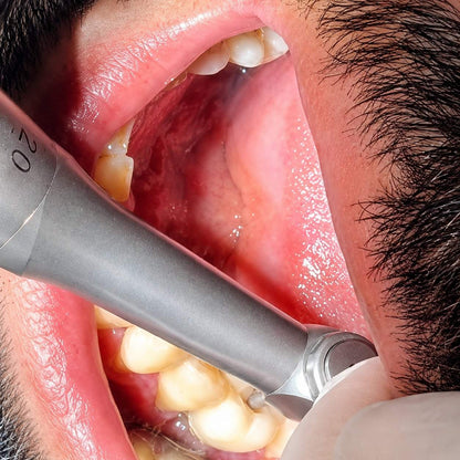 Dental Digital Torque Implant Driver