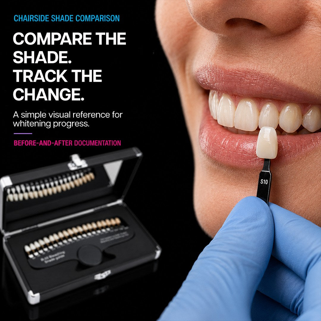 shade tab held next to patient teeth for whitening shade comparison