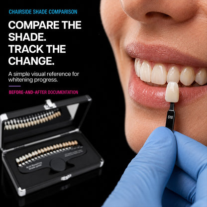 shade tab held next to patient teeth for whitening shade comparison