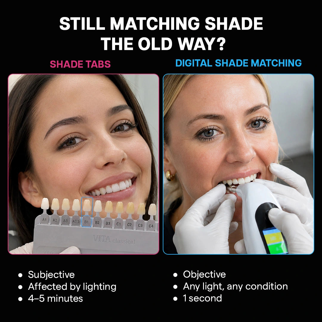 comparison of manual shade tabs and a digital shade matching device