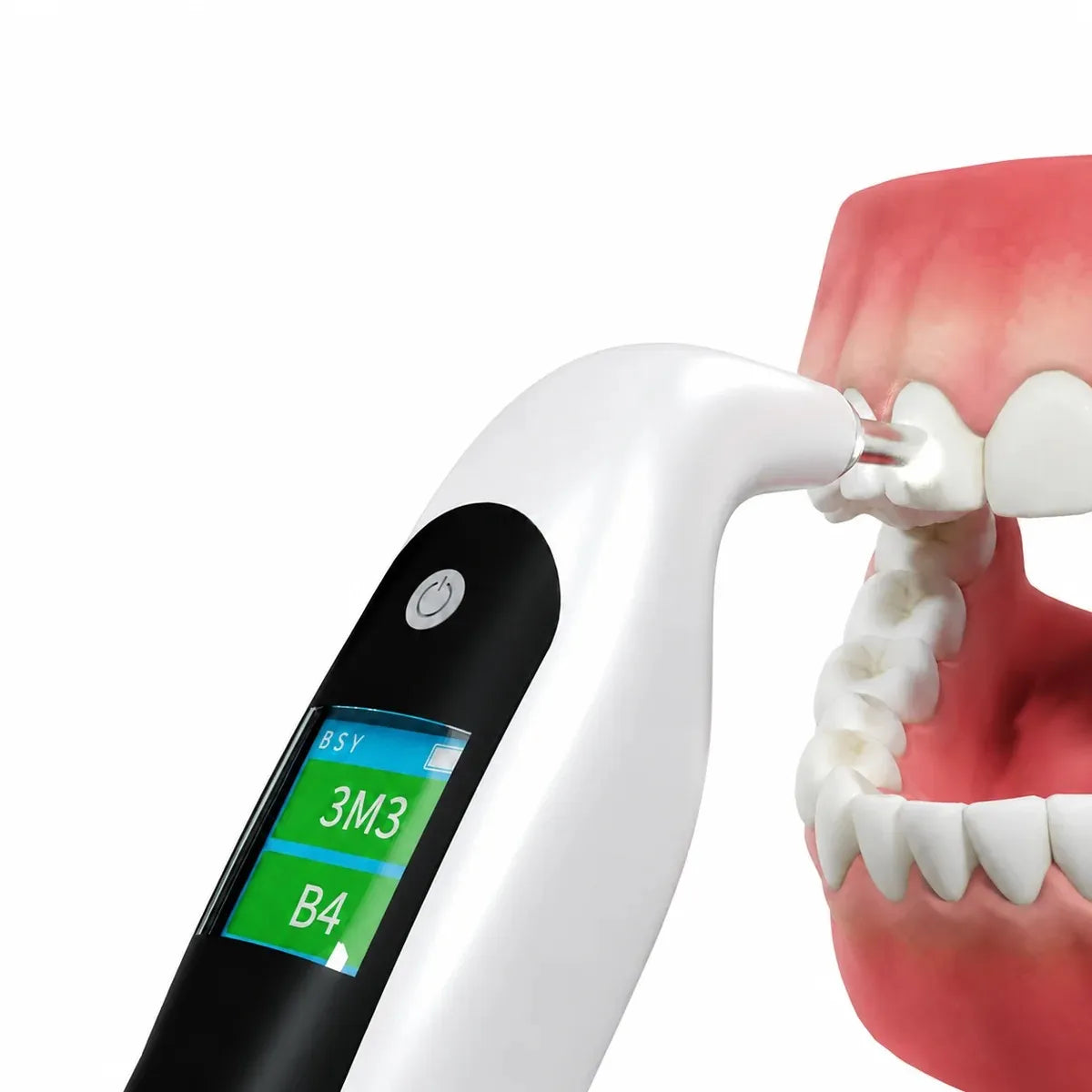Tooth shade analyzer measuring color on a dental model