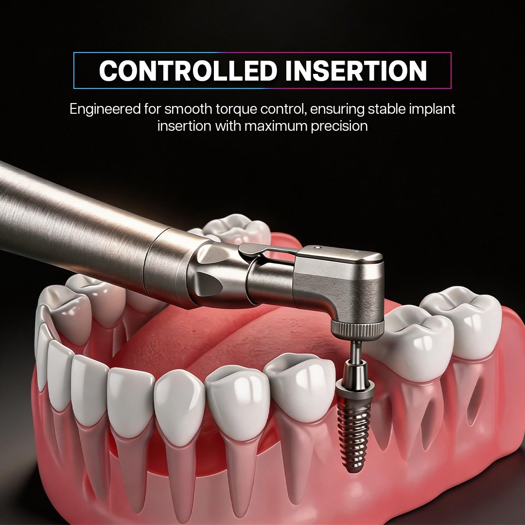 Variable Torque Implant Driver